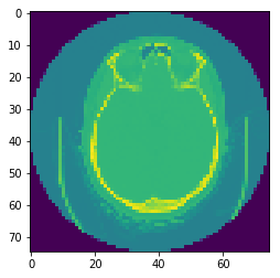 DICOM CT Scan Example